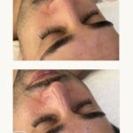 Soins de visage