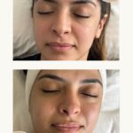 Soins de visage