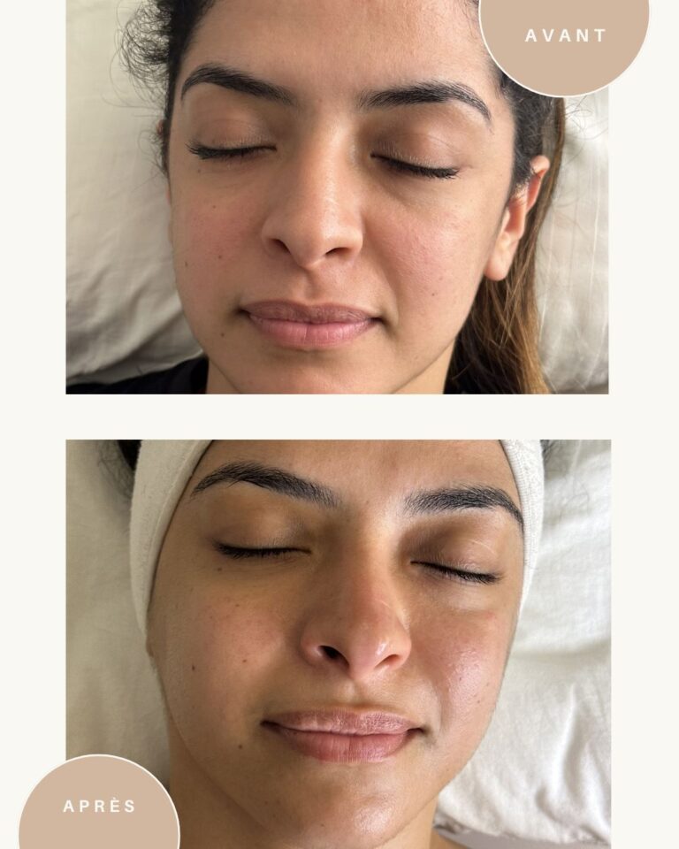 Soins de visage