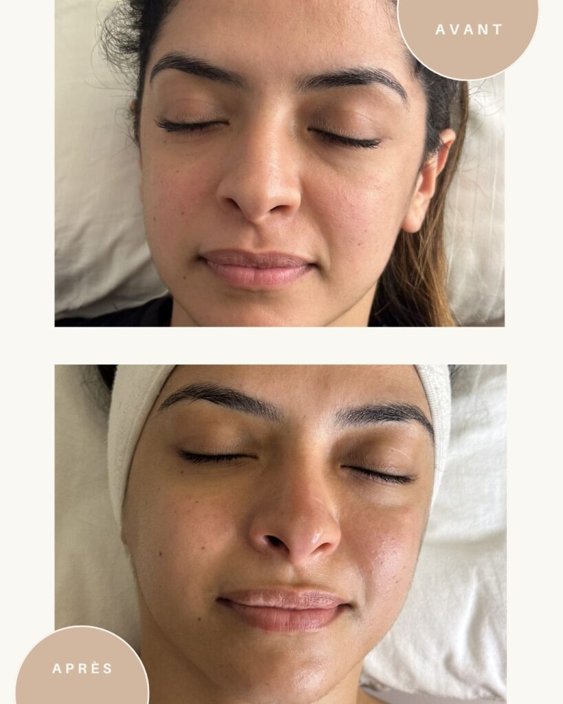 Soins de visage