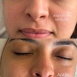 Soins de visage