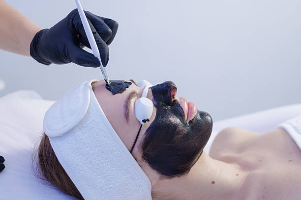 Carbon peel