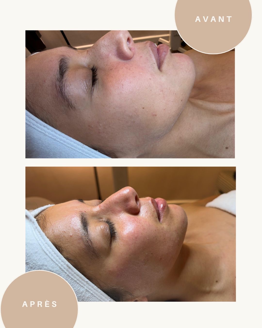 Soins de visage
