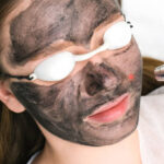 Carbon peel