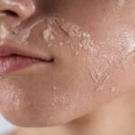 Peeling
